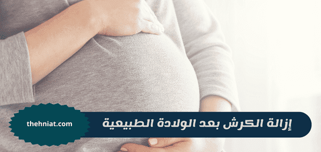 إزالة الكرش بعد الولادة الطبيعية