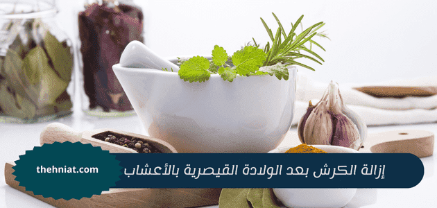 إزالة الكرش بعد الولادة القيصرية بالأعشاب,